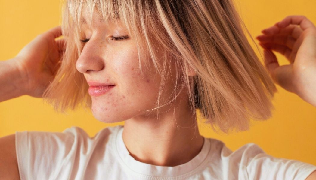 Close up of young blonde woman with facial acne on orange background.