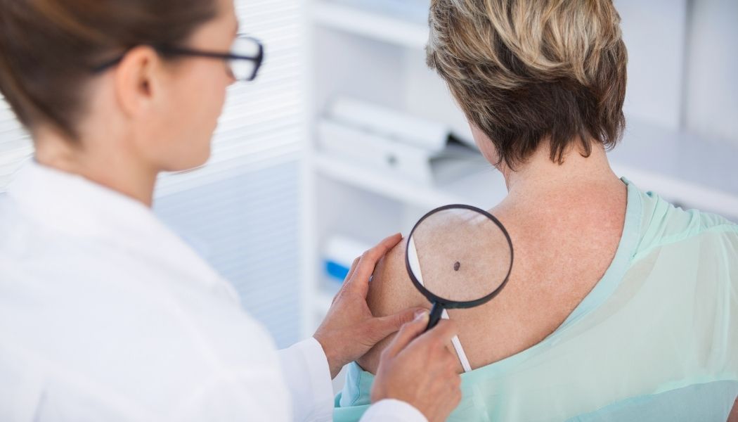 Dermatologist examining mole of female patient with magnifying glass during Melanoma Awareness Month.